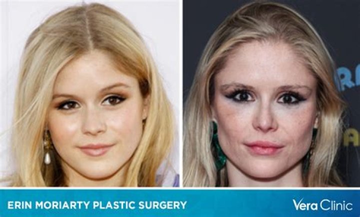 Alexa Demie’s Age, Ethnicity, and Truth About Plastic Surgery Rumors