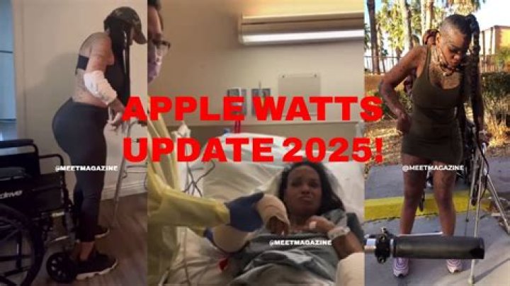 
Apple Watts Accident Update, Age On Instagram – Jontelle Watts Injuries As She Fights For Her Life 