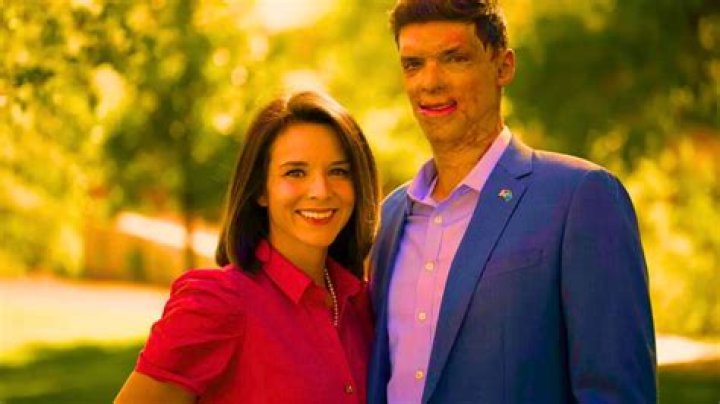 
Captain Sam Brown Wikipedia – Wife Amy Brown, Before And After Injury Photos 