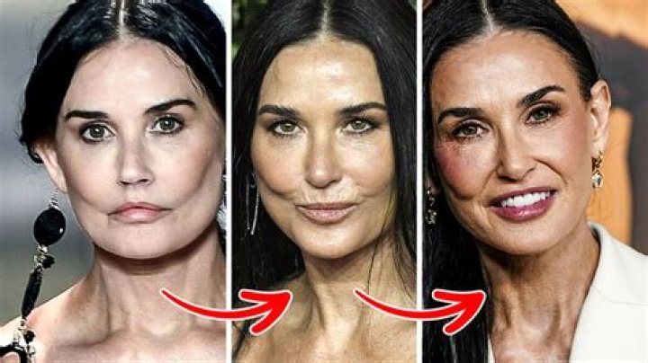 Demi Moore Plastic Surgery Update,What Has She Done To her Face?