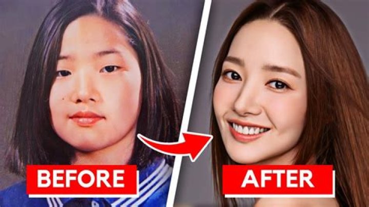 Did BoA Kwon Get Plastic Surgery?Who is BoA Kwon?