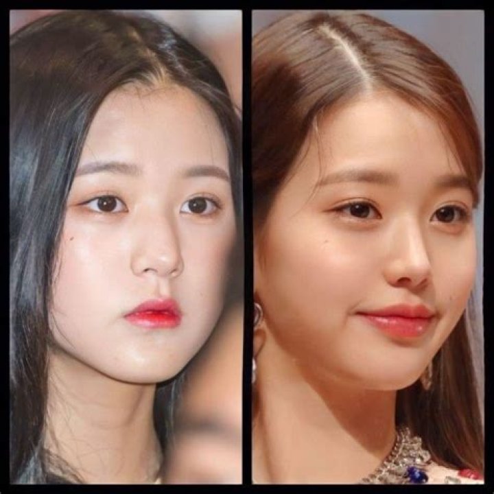 Did Jang Wonyoung Do Plastic Surgery On Her Face? See The Singer’s Before And After Pics