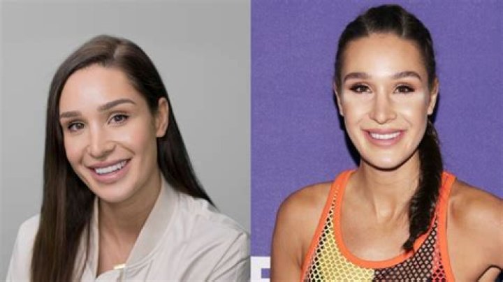 
Did Kayla Itsines Get A Nose Job? Before & After Pictures of The Fitness Instructor 