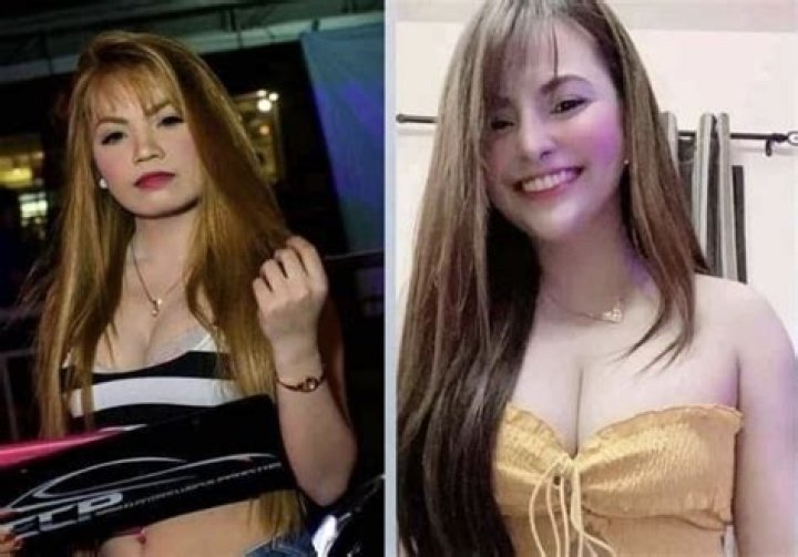 Did Lai Austria Get Plastic Surgery? Before & After Pictures Of The Model