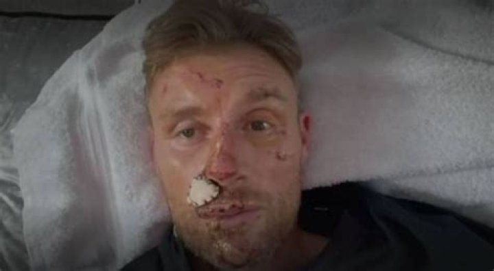 
Does Freddie Flintoff Have An Eating Disorder? Fans Worried About His Health 