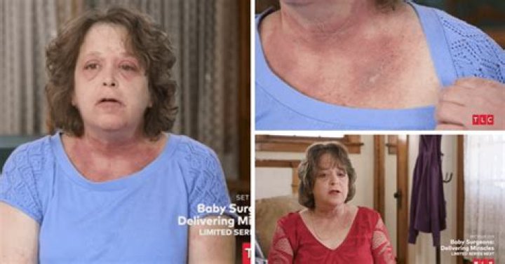 
‘Dr Pimple Popper’ Season 8: Dr Sandra Lee succesfully finds correct diagnosis for Donna 