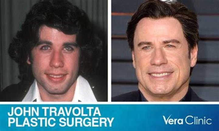 
Has John Travolta Had Plastic Surgery? Who is John Travolta? 