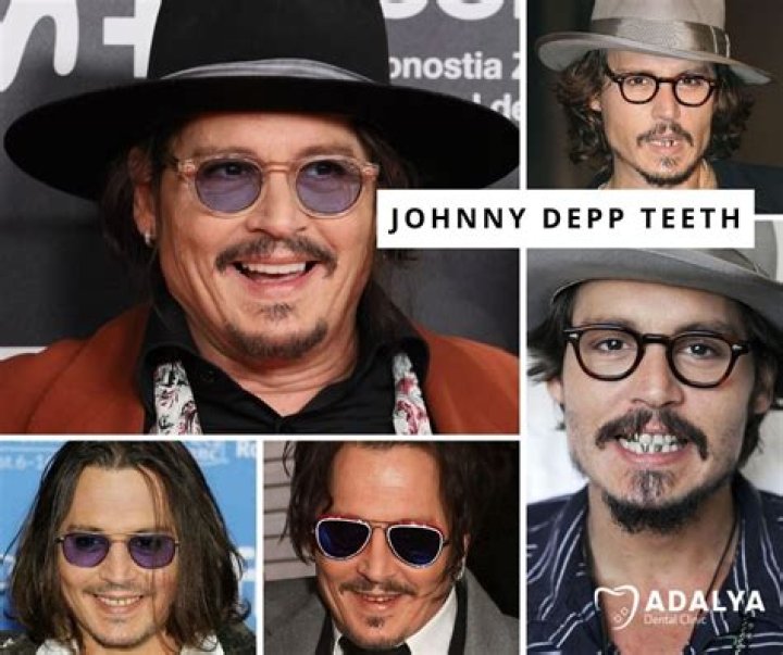 
How did Johnny Depp’s finger get severed in Australia? What surgeons said 