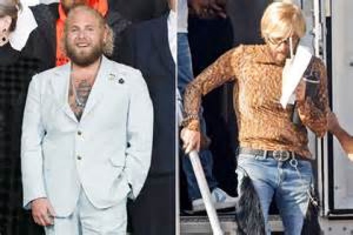 
How Is Jonah Johnston Health After Teeth Surgery? Fans Are Worried After Getting The News 