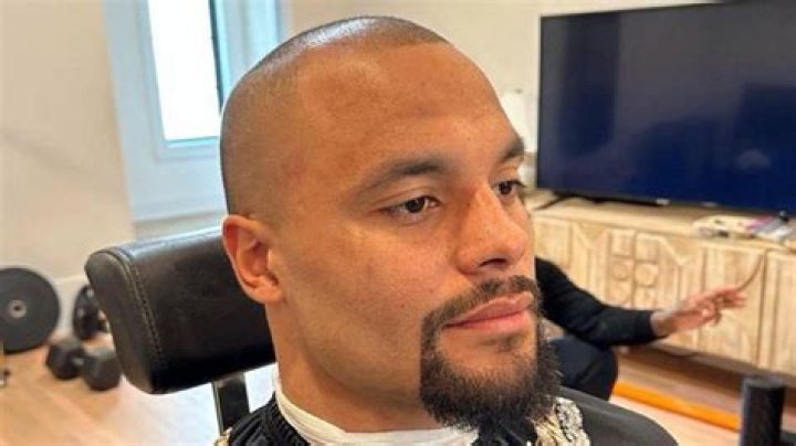 Is Dak Prescott Bald Now Or Does He Have A Cancer? Hair Loss Update