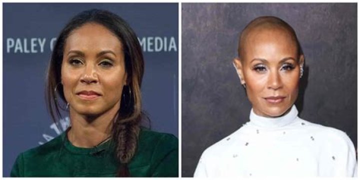 Is Jada Pinkett Smith Bald In Real Life? Alopecia Update, Does She Wear A Wig?