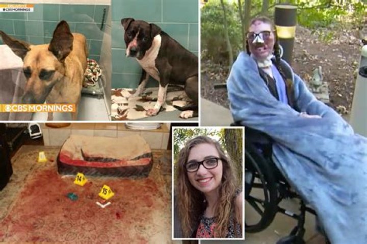 Jacqueline Durand Face Injuries After Texas Dog Walker Mauled