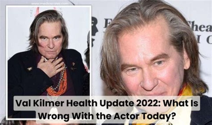 
Jeff Bridges Illness & Health Update 2022- What happened To His Voice? 