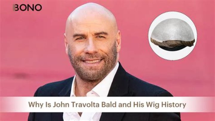 
John Rich is he bald? How Did The American Country Music Singer Hair End Up? 