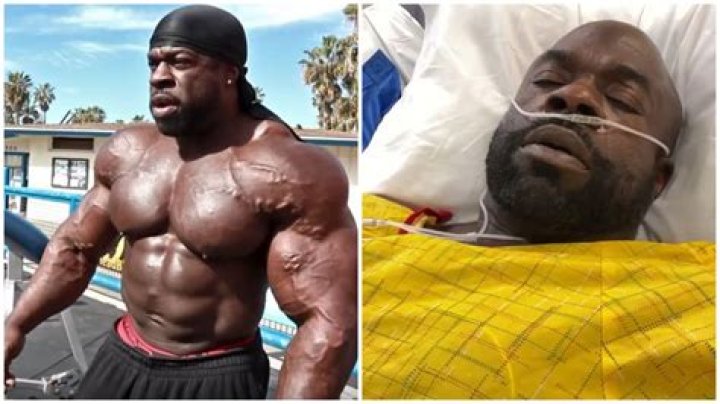 
Kali Muscle Heart Attack And Health Update: Wife Family And Net Worth 