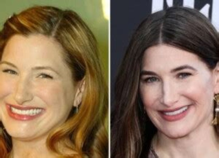 Kathryn Hahn Nose Surgery: Before And After Photo