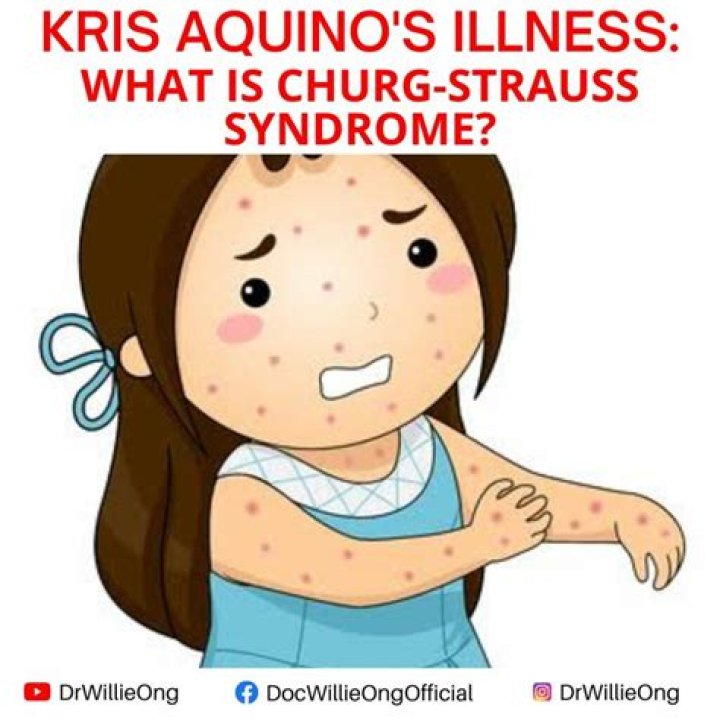 
Kris Aquino Illness And Health Problems -What Happened To Her? 