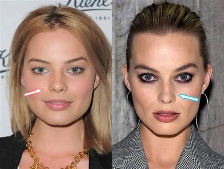 Margot Robbie Botox And Nose Job | Did She Get Surgery