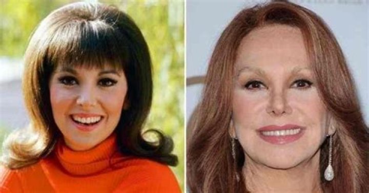 Marlo Thomas Plastic Surgery: What Happened To Her Face?
