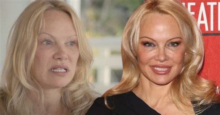 
Pamela Anderson Illness And Health Update: What Happened To Her? 