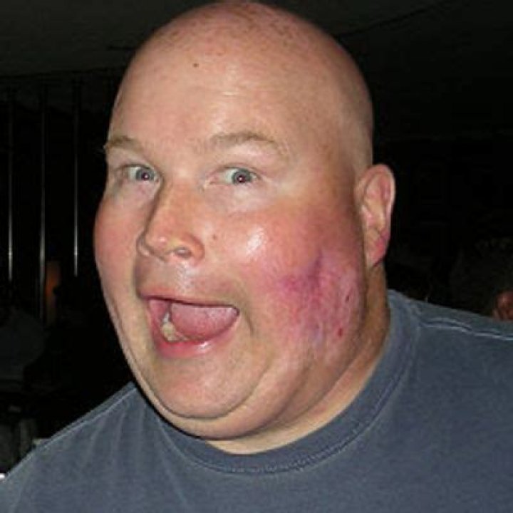 
Patrick Philbin Passed Away At The Age Of 59 