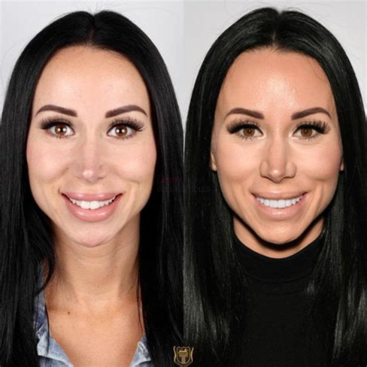 Rachel Fuda Nose Job and Plastic Surgery Distract Viewers