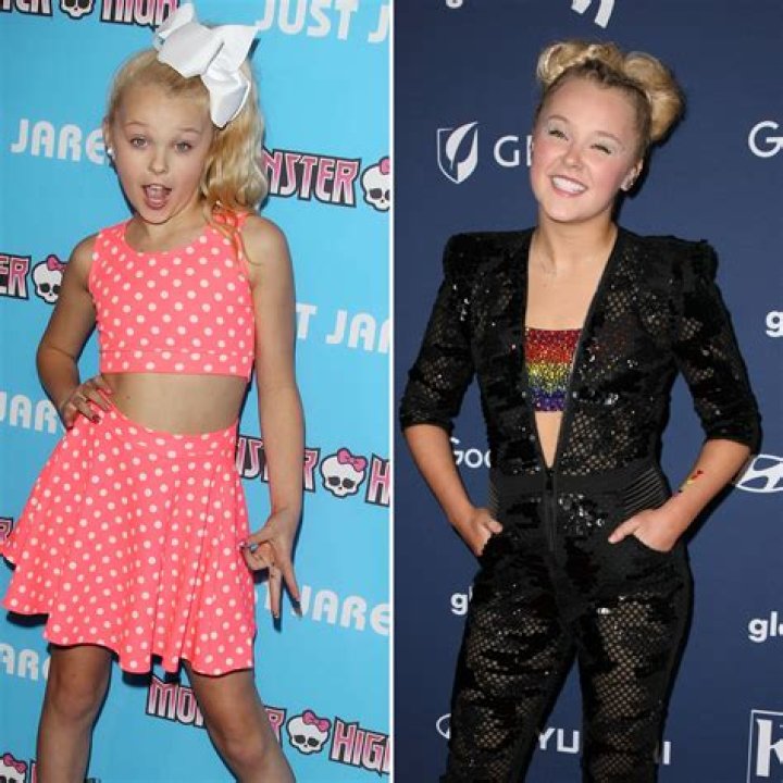 SYTYCD 2022 JoJo Siwa Weight Loss Journey With Her Before And After Photos