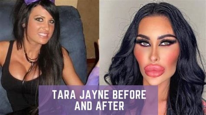 
Tara Jayne Mcconachy Before And After Surgey- Botched Star Sighted In Melbourne 