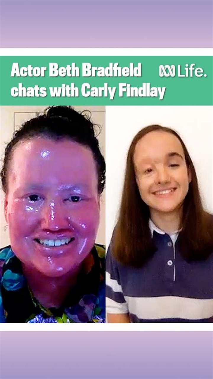 What Happened To Beth Bradfield Eye? Know About Her Injury