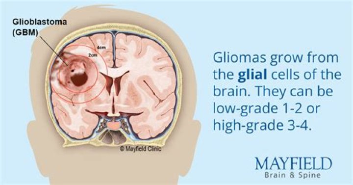 What is Glioblastoma? Tributes pour in as Neebs Gaming’s Thick44 passes away at 47