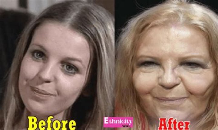 
What Type Of Illness Does Sally Thomsett Have? Face Surgery And Transformation Facts Here 