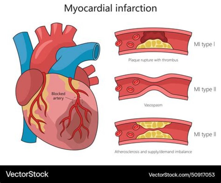 
Who Was Sam Polledri? Former Bristol Rugby Player Heartbroken As Brother Dies From Myocardial Infarction 